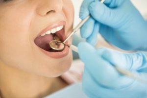 dental checkup