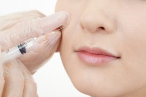 botox treatment